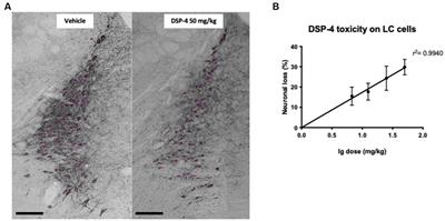 Possible role of locus coeruleus neuronal loss in age-related memory and attention deficits